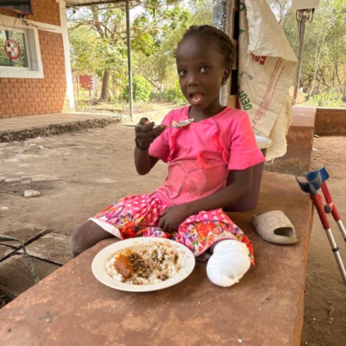 A girl with a cast on her leg eating a meal